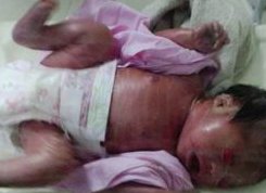 江门市生孩子做染色体检查有必要吗，筛查一次大概需要多少钱？